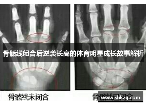 骨骺线闭合后逆袭长高的体育明星成长故事解析